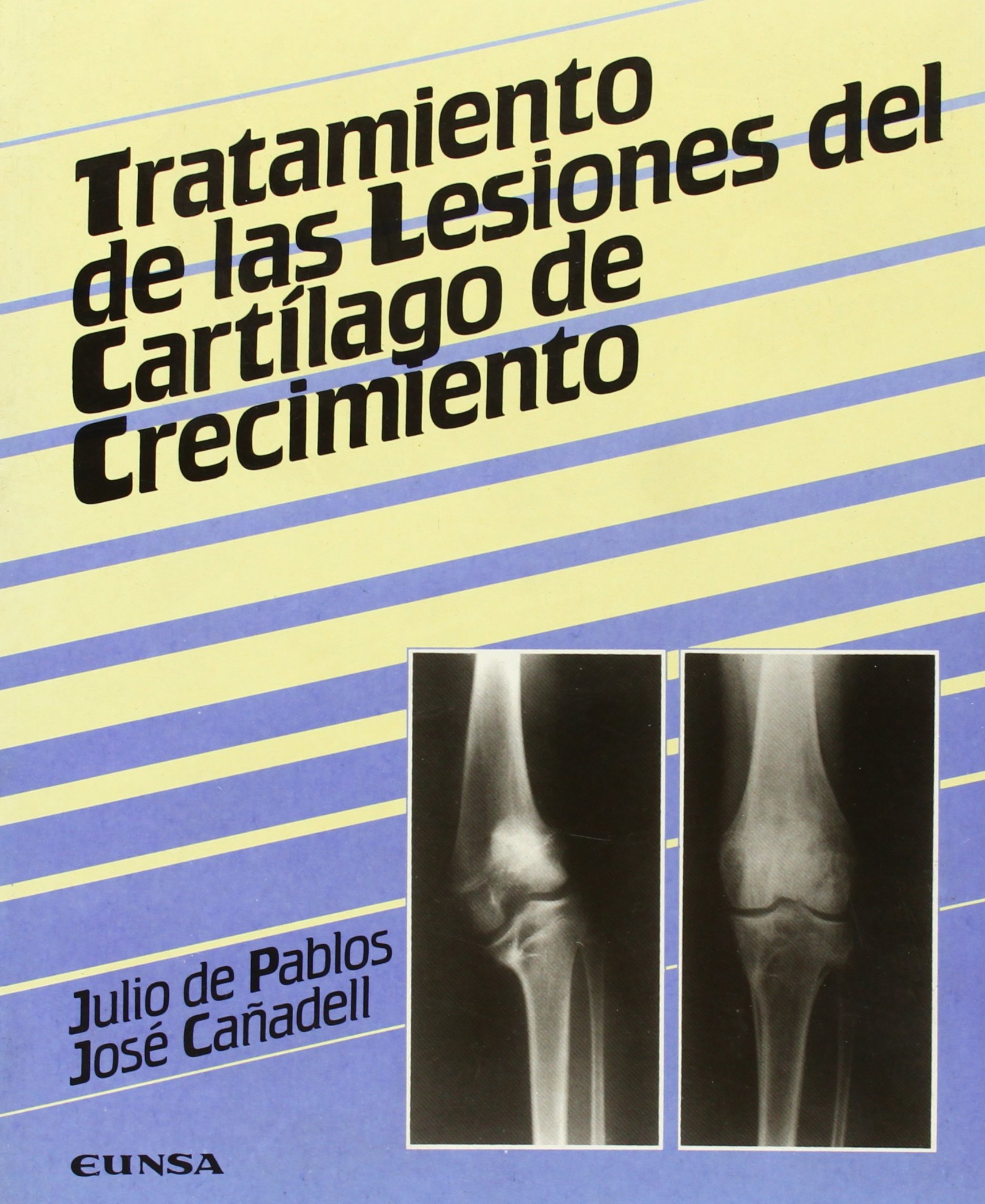 Tratamiento de las lesiones del cartílago de crecimiento (Libros de ...